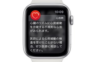Apple Watch、心電図アプリや不規則な心拍の通知機能を日本で解禁