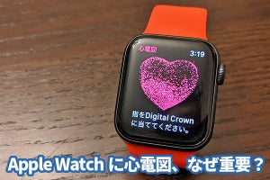 Apple Watchに心電図、なぜ重要？　米国では心房細動を発見した体験談続々