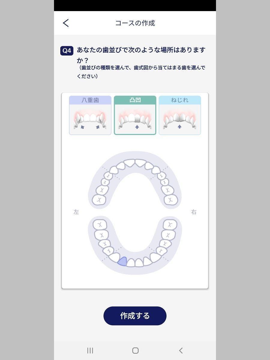 Panasonic - 新品未使用パナソニック電動歯ブラシ ドルツ Doltz 黒 EW