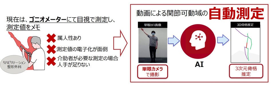 富士通 Aiが患者のリハビリ動画から肩と肘の関節可動域を自動測定する製品 Tech