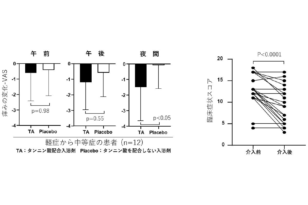 アトピー性皮膚炎の痒み改善に タンニン酸 を入れた入浴が有効 広島大 Tech