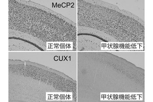 メタボにつながる脂質代謝の異常は腸内環境の変化が原因 名大が解明 Tech