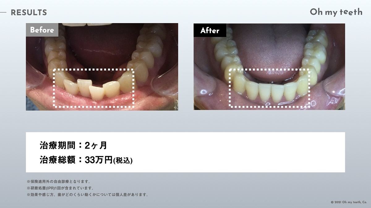 「Oh my teeth for Business」開始
