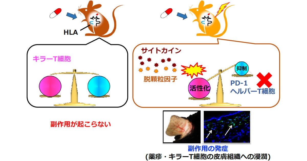 免疫のバランスが崩れると医薬品の副作用が起こりやすくなる 千葉大などが確認 マピオンニュース