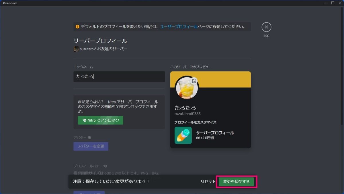 Pc版discordのアカウントをカスタマイズする マイナビニュース