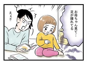 「ギャアァ‼ 両足が腫れてる!」と涙目で訴える子ども。母親が確認すると……、まさかの勘違いに「気づいちゃいましたか笑」「か、かわい過ぎます」とほっこり