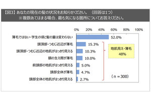 薄毛・抜け毛対策をする理由、30代は「恥ずかしい」が最多!  50代は?