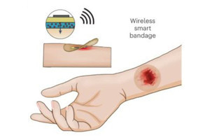 電流を流して傷を素早く治す「スマート絆創膏」を開発 - スタンフォード大学