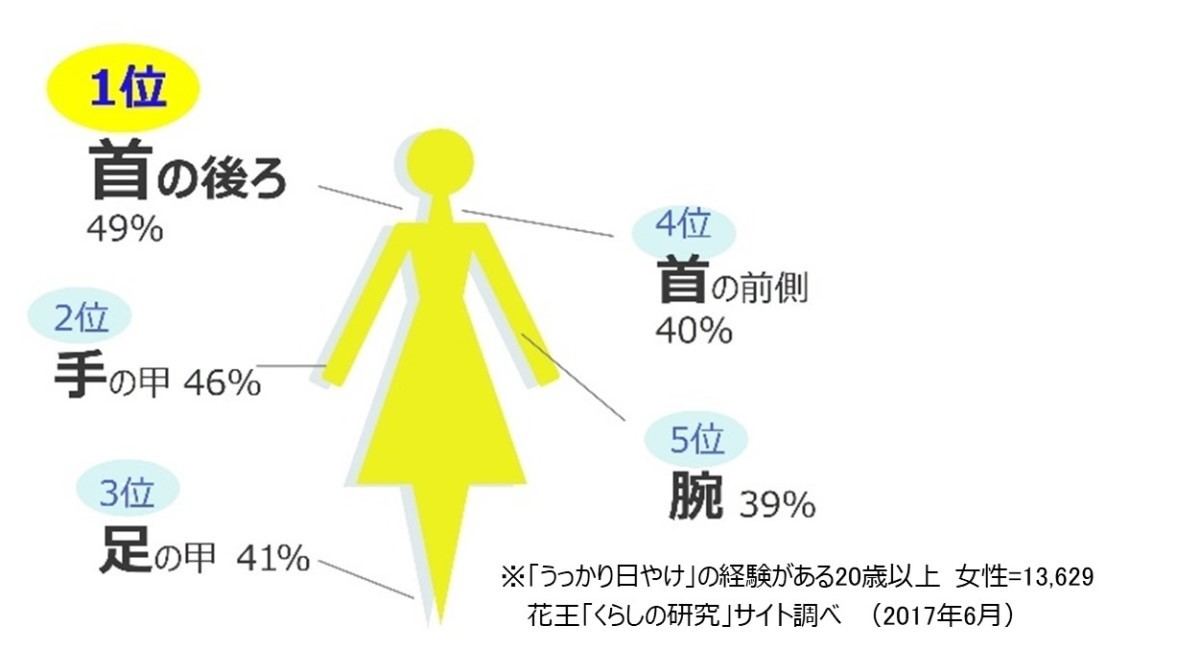 うっかり日やけ部位　