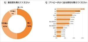 アトピー体質の人に聞いた、入浴頻度はどれくらい?