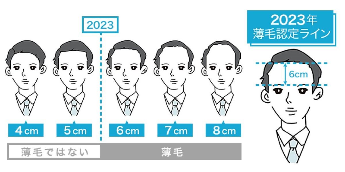 薄毛の境界線