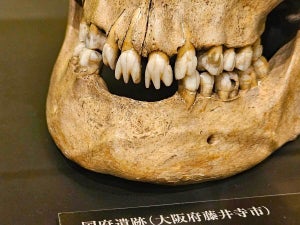 “縄文マッチョ”に出っ歯の鎌倉人、江戸は小顔で歯並びが悪かった!? 骨が伝える日本人の驚きのビジュアル変容