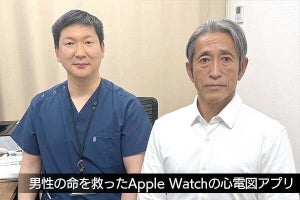 男性の命を救ったApple Watch、不整脈の専門医も太鼓判を押す「心電図」アプリ