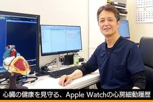 心臓の健康を見守るApple Watchの心房細動履歴、専門医に「正しい使用方法」を聞いた