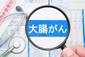 「大腸がん」は早期発見・早期治療が重要 - 初期症状はある? 