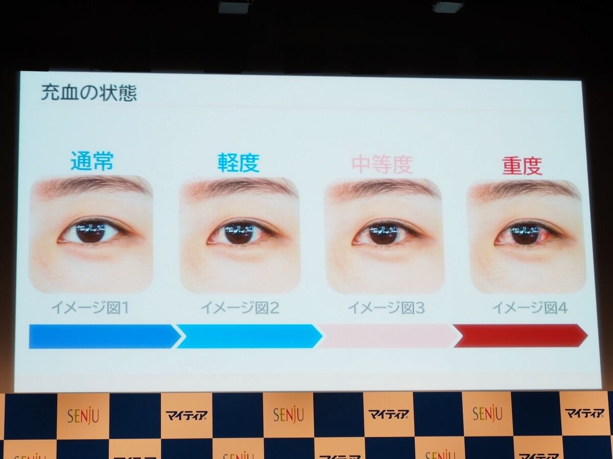 充血の度合いイメージ