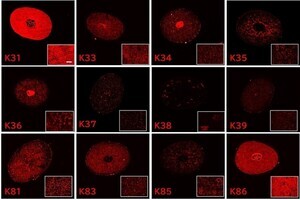 クセ毛の本質とは? 蛍光イメージング技術で毛髪の内部構造の可視化に成功