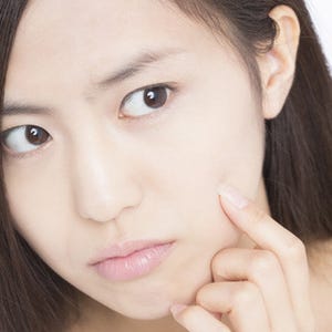 唇の水疱 ヘルペスじゃない場合は口唇炎かも 違いや対処法を医師が解説 マイナビニュース