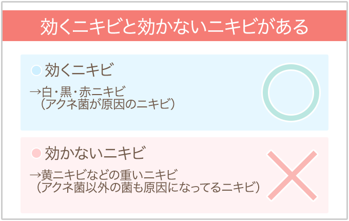 過酸化ベンゾイルの効くニキビと効かないニキビ