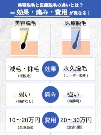 メンズ美容脱毛と医療脱毛の違い