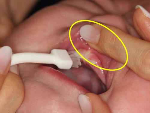 赤ちゃんの歯 きちんと磨けてる 歯科医師が教える乳歯ケアのコツ マイナビニュース