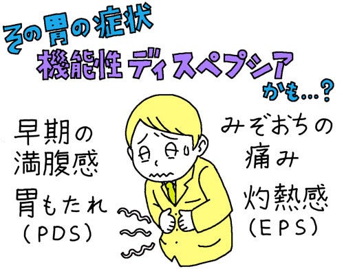 ストレスフルな社会人の胃の不快感 もしかして 機能性ディスペプシア かも マイナビニュース