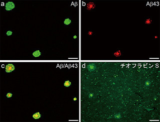 理研ら、「Aβ43」をアルツハイマーの強力な病態促進因子であることを発見