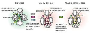 京大、腎臓の繊維化と腎性貧血の原因を究明 - 治療方法も開発