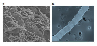 東大、免疫細胞「Th17」の誘導活性を持つ腸内細菌「SFB」の全ゲノムを解明