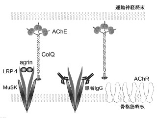 名大、重症筋無力症における筋力低下が起こる病態メカニズムを明らかに