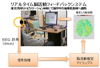 ATRと慶応大、リハビリに応用可能な脳ダイナミクス推定技術を開発
