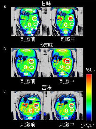 九大、顔の皮膚血流が味覚の好き嫌いに応じて特異的な反応をすることを発見