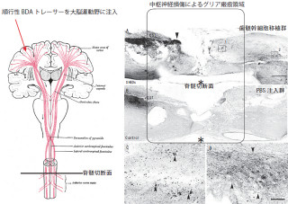 歯の「歯髄幹細胞」で切断した脊髄神経も治せる可能性あり! - 名大が発表