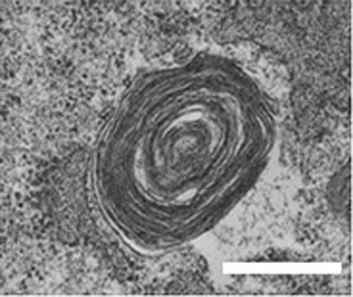 理研、哺乳類の細胞内小器官中に古細菌型の脂質が存在することを確認