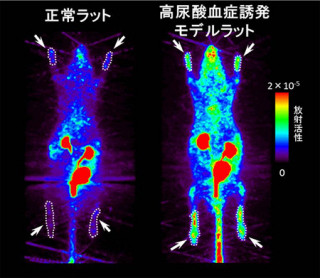 理研ら、炭素の放射性同位体で標識して生体内の尿酸分布などの可視化に成功