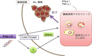 北大、悪玉マクロファージを寝返らせて逆にがんを攻撃する技術を開発