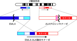 JSTやがん研究会など、肺がんの原因の1つとなる新たな融合遺伝子を発見