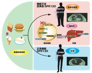 京大、食事性肥満の原因遺伝子は脂肪センサ「GPR120受容体」と確認