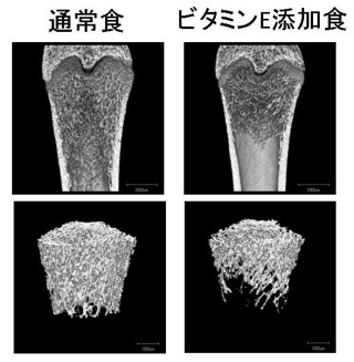 ビタミンEの限度を超えた摂取は骨粗鬆症を招く可能性あり -慶応大らが解明