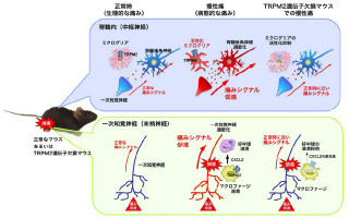 京大、慢性痛が発生する仕組みを解明 - 新たな鎮痛剤の創薬に期待