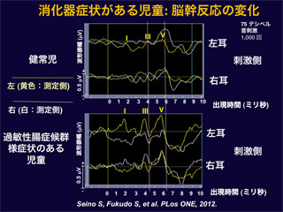 母親のケアが少なく、過保護が多いと消化器症状を持ちやすくなる - 東北大