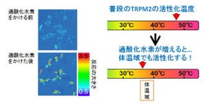 生理研、マクロファージが体温センサ「TRPM2」で活性化する仕組みを解明