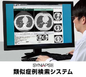 富士フイルム、人工知能による肺がんの画像診断サポートシステムを開発