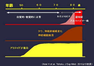 GEヘルスケア、東北大ベンチャー・クリノとアルツハイマーの共同研究開始