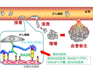 北大、がん細胞の肺への転移が引き起こされるメカニズムを明らかに