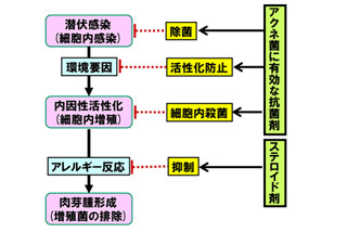 難病「サルコイドーシス」の原因菌はアクネ菌 - 東京医科歯科大などが解明