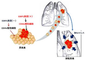 慶応大など、乳がん細胞の肺への転移を促進する分子機構を解明