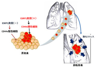 慶応大など、乳がん細胞の肺への転移を促進する分子機構を解明