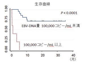「EBウイルス」のDNA量が「NK細胞リンパ腫」の治療指針に有効 - 名大など