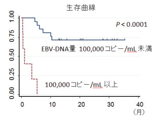 「EBウイルス」のDNA量が「NK細胞リンパ腫」の治療指針に有効 - 名大など